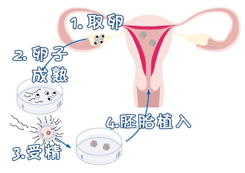 借卵代孕哪里做的最好